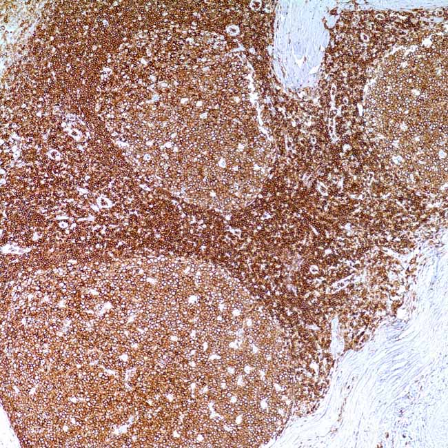 CD45 (LCA)