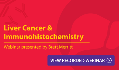 Liver Cancer & Immunohistochemistry