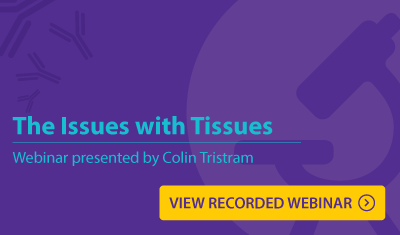 The Issues with Tissues