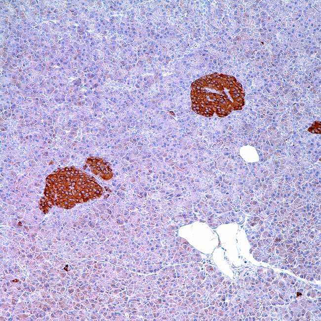 Synaptophysin